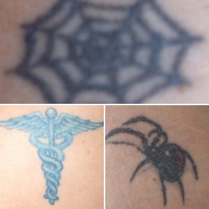 Tattoos